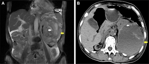 Figure 1 Imaging for Cases 1 and 2.