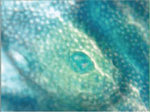 Figure 1. An example of the very few discrete (or well defined) aberrant crypt foci (ACF) observed in animals on Diet B in Study 3. Note the slit-like lumens likely indicative of a dysplastic histology. (The mucosal field is 1.7 × 0.8 mm.)