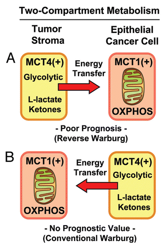 Figure 7 Two-compartment tumor metabolism: MCT4 expression and the Warburg effect. Here, we directly compared the prognostic value of stromal and epithelial MCT4 expression in triple-negative breast cancer patients within the same patient cohort. MCT4 expression is a specific marker of aerobic glycolysis (with enhanced L-lactate and ketone production), also known as the Warburg effect. Our results directly show that high stromal MCT4 levels are specifically associated with poor overall survival (A). In contrast, expression of MCT4 in epithelial tumor cells had no prognostic value (B). Thus, only induction of the Warburg effect in the tumor stroma has prognostic value. In both (A and B), note that glycolytic MCT4(+) cells would be metabolically coupled with oxidative mitochondrial metabolism (OXPHOS) in adjacent MCT1(+) cells, resulting net energy transfer (red arrows). MCT4 normally functions in L-lactate efflux/export, while MCT1 functions in L-lactate uptake/import.