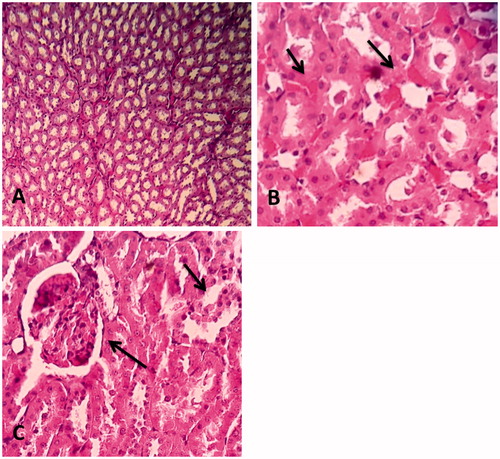 Figure 3. Comparison of structural changes in the kidney due to injection of STZ and treatment by PSO between groups. (A) Represents a normal rat kidney. All anatomical structures look normal (×100), (B) group 2 treated with STZ 65 mg/kg, severe inflammatory cells infiltration and hyaline casts (×400), and (C) minimal inflammatory cells infiltration and moderate glomerular congestion have been seen (×400).