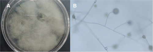 Figure 2 (A) Sabouraud dextrose agar: Villous colonies after 48 hours. (B) Light microscope×200: large sporangia, rhizoids, hold capsule upright vertical.