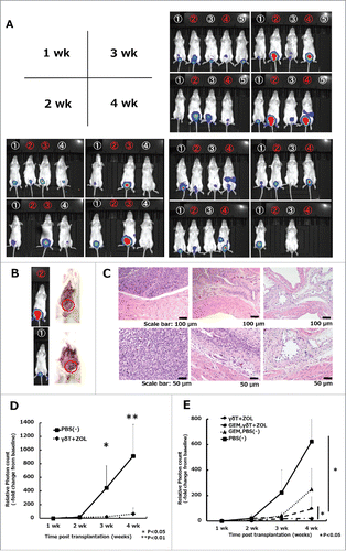 Figure 6. In vivo effects of Vγ9Vδ2 T cell weekly intravesical repeat treatment in combination with gemcitabine in an orthotopic mouse model. (A) Effects of weekly repeat treatment with γδT cells combined with 5 μM ZOL. Numbers in white denote γδT cell plus ZOL-treated mice, whereas numbers in red denote PBS-treated mice (vehicle control). The bioluminescense intensity of γδT cell plus ZOL-treated mice was markedly inhibited when compared with that in the vehicle-control arm, especially at 3 and 4 weeks. A blank space under the number indicates that the mice died during the analysis period. Representative images of three independent experiments are shown. (B) Representative laparotomy findings on day 30. Upper: PBS treatment; lower: γδT cell with 5 μM ZOL treatment. (C) Representative images of H&E-stained bladder sections on day 30. Left: PBS-treated mouse; middle: γδT cell-treated mouse; right: non-tumor transplanted mouse (control). Original magnification: × 10 (upper panels), × 20 (lower panels); scale bars: 100 μm (upper panels), 50 μm (lower panels). (D) Results of IVIS measurements. Experimental design is shown in Fig. 5B. Tumor growth was detected by cancer cell expressing luciferase signal (exposure: 3 min; binning: large) and bioluminescence intensity was quantified using the region of interest (ROI) tool. Results are expressed as the mean ± SEM (n = 6–7 per group). (E) Results of IVIS measurements in the four groups. The experimental design is shown in Fig. 5C. Tumor burden and bioluminescence intensity were most reduced in the ZOL and γδT cell in combination with the gemcitabine group when compared with the other groups. Weekly, repeated pretreatment with GEM (5 μM; dissolved in 200 μL PBS; four i.p. injections) synergistically enhanced the cytotoxicity of γδT cells when compared with the GEM untreated group in vivo with a statistically significant difference. Results are expressed as the mean ± SEM (n = 4–6 per group). Statistical significance is displayed as ** for P < 0.01 and * for P < 0.05.