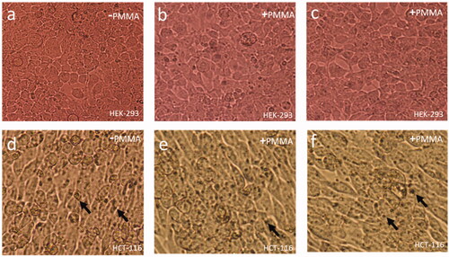 Figure 4. Cell Morphology of HEK-293 and HCT-116 cells after 24 h of treatment of PMMA: (a) control, (b) 5.0 μg/mL and (c) 7.5 μg/mL of HEK-293 cells. (d) Control, (e) 5.0 μg/mL and (f) 7.5 μg/mL of HEK-293 cells. Nuclear condensation (arrows) (400× magnifications).