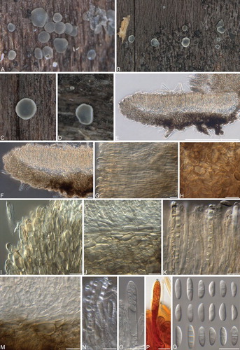 Fig. 8 Phialocephala mallochii. A–D. Apothecia on decaying Betula alleghaniensis log. E, F. Vertical sections of apothecia. G. Marginal cells. H. Ectal excipulum cells. I. Marginal cells with refractive vacuole bodies. J. Ectal and medullary excipulum. K. Refractive vacuole bodies of paraphyses. M. Ectal and medullary excipulum. N. Refractive vacuole bodies of paraphyses. O. Ascus. P. Ascus with hemiamyloid tip in Lugol’s solution after KOH pretreatment. Q. Ascospores. Bars: E = 500 μm, F–Q = 10 μm.