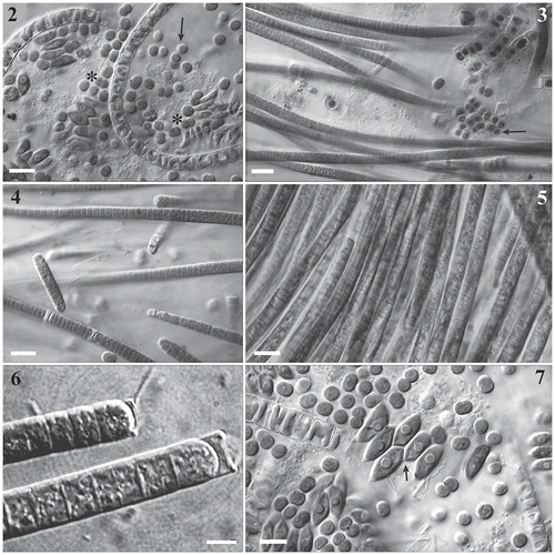 Figs 2–7. Light micrographs of the main phototrophs composing cultured biofilms. Fig. 2. Chains of Diadesmis confervacea are shown together with pointed Scenedesmus sp. cells, round (arrow) and dividing (asterisks) cells of Synechocystis sp.; Fig. 3. Chroococcus sp. (arrow); Fig. 4. Oscillatoria tenuis; Fig. 5. Phormidium autumnale; Fig. 6. Phormidium sp.; Fig. 7. Scenedesmus sp. colony (arrow). Scale bars: 10 µm.