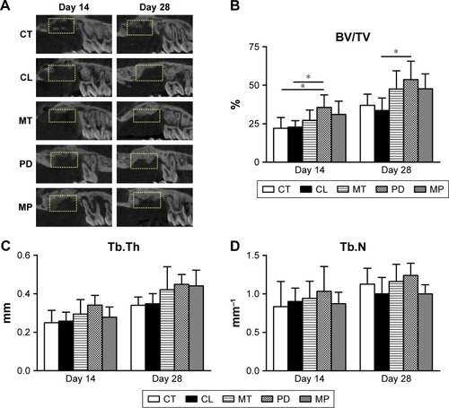 Figure 5 The micro-CT assessments of the FGM on the alveolar ridge on days 14 and 28.Notes: (A) The representative sagittal sections from each group on days 14 and 28. Dash boxes indicate the osseous defects. (B) The bone volume fraction, defined as the ratio of bone volume to the entire volume of defect (BV/TV). (C) The mean trabecular thickness (Tb.Th). (D) The mean trabecular number (Tb.N) per square millimeter. *P<0.05.Abbreviations: BV/TV, bone volume fraction; FGM, functionally graded membrane; Tb.N, trabecular number; Tb.Th, trabecular thickness; CT, no membrane control; CL, membrane with the core layer only; MT, membrane with PDLLA-MTZ layer; PD, membrane with the PDLLA-PDGF layer; MP, membrane with both PDLLA-MTZ and PDLLA-PDGF layers.