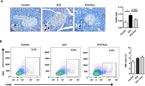 Figure 7 Effect of exosomes (Exo) on macrophage infiltration in mice treated with streptozotocin (STZ).