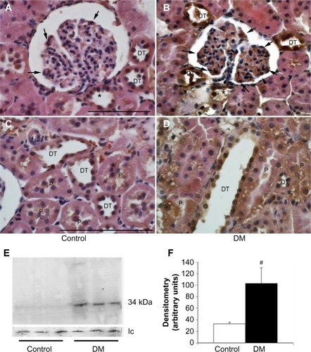 Figure 4 The expression of the prorenin receptor in normal and diabetic rats.