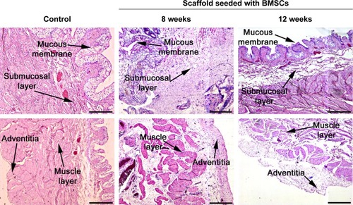Figure 7 Histological sections of the reconstructed bladder wall stained with H&E.Notes: The intact bladder wall was used as control. Scale bar, 200 μm.Abbreviations: BMSCs, bone marrow stromal cells; H&E, hematoxylin and eosin.
