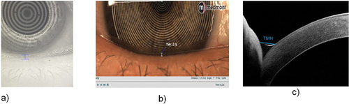 Figure 1. Tear meniscus height measurement examples using Oculus Keratograph 5 M (a), Medmont Meridia (b), and Spectralis SD-OCT (c) The images were cropped and resized to enable better visualisation.