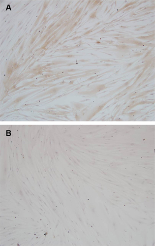 Figure S1 Immunohistochemical HGF staining.Notes: (A) Cells positive for vimentin staining. (B) Cells negative for anti-keratin staining.Abbreviation: HGF, human gingival fibroblast.