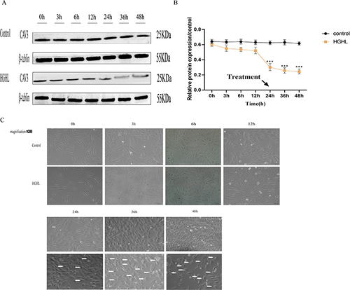 Figure 1 HGHL-Induced CAV3 Protein Expression Downregulation and Morphological Injury in H9c2 Cells. HGHL treatment downregulated CAV3 protein expression in a time-dependent manner, with a significant decrease at 24 hours observed using Western blot analysis (A and B). The data were presented as mean ± SD, with n = 6 per group. Microscopic observation (200× amplification) revealed HGHL treatment resulted in increased morphological damage to H9c2 cardiomyocytes (C). The scale bars in the panel were 50 μm. The statistical significance of the observed effects was indicated by ***P<0.001.