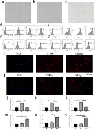 Figure 2 THP-1 cells were induced to differentiate into macrophages. (a) After PMA induction, THP-1 cells changed from suspension cells to adherent M0 macrophages. (b) M0 macrophages were induced to differentiate into M1 macrophages by LPS and IFN-γ treatment; the cell morphology was long and spindle-like, and the volume increased. (c) M2 macrophages induced by IL-4 and IL-13 showed dendritic processes and increased cell volume (magnification, 20x). (d and e) Flow cytometry showed high expression of CD68 and CD11b in M0, M1 and M2 macrophages. (f) M1 macrophages showed significant upregulation of CD86 expression. (g) M2 macrophages displayed higher expression of CD163. (h and i) Immunofluorescence showed that the expression of CD86 was higher in M1 macrophages and that of CD163 was higher in M2 macrophages. (j–l) Compared with M0 and M2 macrophages, M1 macrophages had significantly upregulated expression of iNOS, TNF-a and IL-1β. (m–o) The mRNA expression of Arg-1, TGF-β, and IL-10 in M2 macrophages was significantly higher than that in M0 and M1 macrophages (*p < 0.05, **p < 0.01).