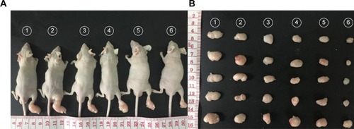 Figure 9 In vivo combined PDT and chemotherapy efficacy assay (Gem equivalent: 50 mg/kg).Notes: (A) Representative photos of tumors on mice in each treatment group. (B) Photographs of tumors harvested from each treatment group taken on day 14. (C) The body weight profiles of mice in different treatment groups. (D) The tumor volume profiles of mice in different treatment groups. 1–6 represent NS group, Gem group, P@ (L+) group, Gem-HSA-NPs group, P@-Gem-HSA-NPs (L−) group, and P@-Gem-HSA-NPs (L+) group, respectively.Abbreviations: Gem, gemcitabine; HSA, human serum albumin; NPs, nanoparticles; NS, normal saline; P@, pheophorbide-a; PDT, photodynamic therapy.