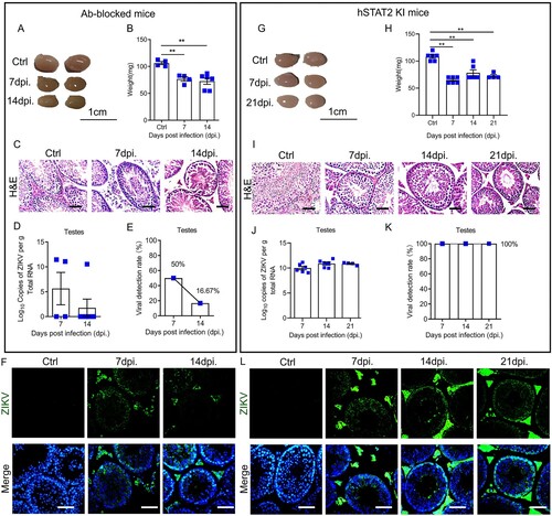 Figure 2. Testicular pathogenesis of ZIKV-infected immunocompetent murine models.(A & B) Representative pictures (A) and weight (B, n = 4-6 testes for each group) of testes from ZIKV-infected Ab-blocked mice; (C) H&E staining of testicular sections from ZIKV-infected Ab-blocked mice at 0-14 dpi. Scale bar, 25 μm;(D-F) ZIKV viral load (D) and detection rate (E) in testes of ZIKV-infected Ab-blocked mice were detected by RT-qPCR (n = 4 testes for each group). Distribution of ZIKV antigens were analyzed by IFA (F). Scale bar, 25 μm;(G & H) Representative pictures (G) and weight (H, n = 4-6 testes for each group) of testes from ZIKV-infected hSTAT2 KI mice; (I) HE staining of testicular sections from ZIKV-infected hSTAT2 KI mice at 0–21 dpi. Scale bar, 25 μm;(J–L) ZIKV viral load (J) and detection rate (K) in testes of ZIKV-infected hSTAT2 KI mice were detected by RT-qPCR (n = 6 testes for each group). Distribution of ZIKV antigens were analyzed by IFA (L). Scale bar, 25 μm. Results were shown as means ± SEM and analyzed using the two-sided Student’s t test. *p < 0.05, **p < 0.01. Nuclei were stained with DAPI.