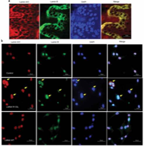 Figure 4. Nuclear morphology and immunohistological staining of lamins in skin tissue and pre-adipocytes.