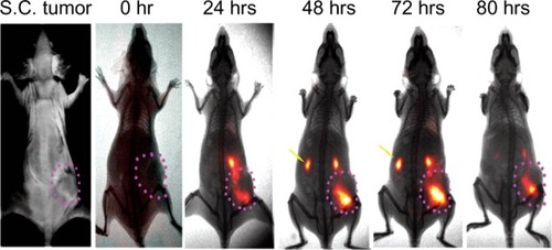 Figure 4 Time dependent accumulation of urokinase plasminogen activator receptor (uPAR) targeted-ATF-nanoparticle-NIR conjugates using amino terminal fragment (ATF) peptide of uPA as uPAR targeting ligands.