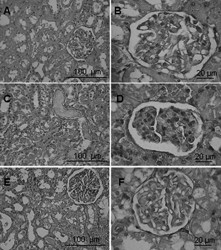 Figure 2.  H&E stained kidney sections. A–B: sham group showing normal tubular and glomerular structure. C–D: In IR group, tubular cell sloughing, nuclear condensation, cast formation, and tubular cell necrosis were found, as was bowman space enlargement. E–F: SFZ pretreatment diminished these alterations in group IR+SFZ.