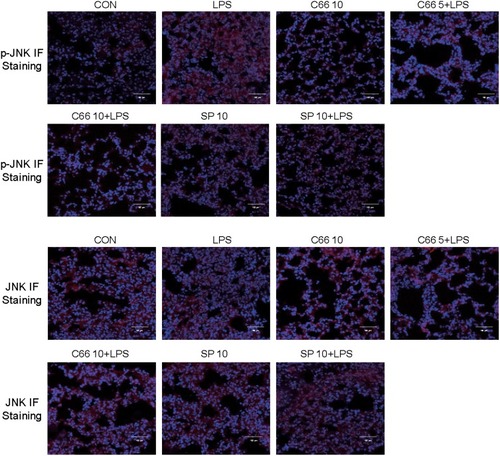 Figure 5 C66 and SP600125 could inhibit LPS-induced JNK phosphorylation in lung tissues. Before LPS administration, mice were given by gavage once a day for 7 consecutive days of C66 (5 and 10 mg/kg) and SP600125 (10 mg/kg). After 6 hrs of LPS challenge, we euthanized mice and then collected lung tissue. JNK phosphorylation in lung tissue was detected by performing immunofluorescence assay.