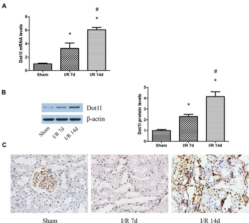 Figure 1 Dot1l was upregulated in the kidneys of rats after I/R injury.