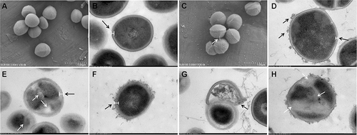 Figure 5 SEM images of WT (A) and ΔatlA cells. TEM images of WT and ΔatlA cells after treatment with 0 (A, B, C and D), 1/4MIC (E and F) and 1/2MIC (G and H) of ZJ-2, respectively. SEM images’s view is 1.00 μm. TEM images’s view is 200 nm. Black arrows are changes in the cell wall. White arrows are septum formation.