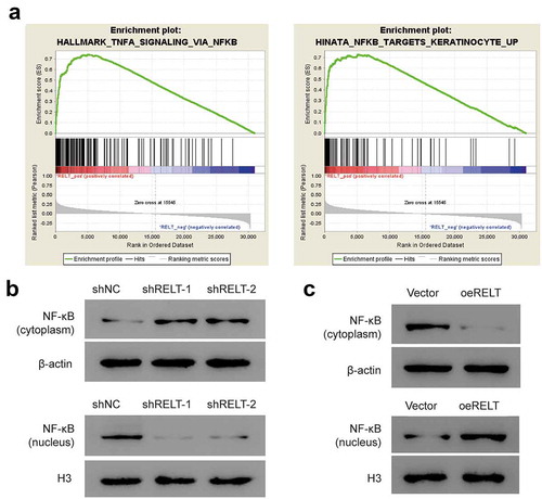 Figure 4. RELT up-regulation activated the NF-κB signaling pathway in the ESCC cells. (a) GSEA showed positive association between high expression of RELT and the NF-κB pathway. (b, c) Western blotting was performed to detect the level of NF-κB in the cytoplasm and the nucleus under the influence of RELT. PDTC, pyrrolidine dithiocarbamate. *, P < 0.05; **, P < 0.01; ***, P < 0.001;***, P< 0.0001