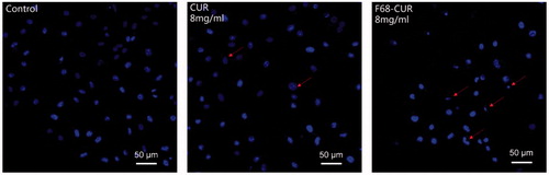 Figure 8. Nuclear morphology of MDA-MB-231 cells treated with free CUR or F68–CUR conjugate micelles for 24 h. Untreated cells served as control. Cells were stained with Hoechst 33342 (blue) and imaged with a laser scan confocal microscope. Red arrows indicate apoptotic cells with smaller nuclear size, more fragmentary cells and less cell number.