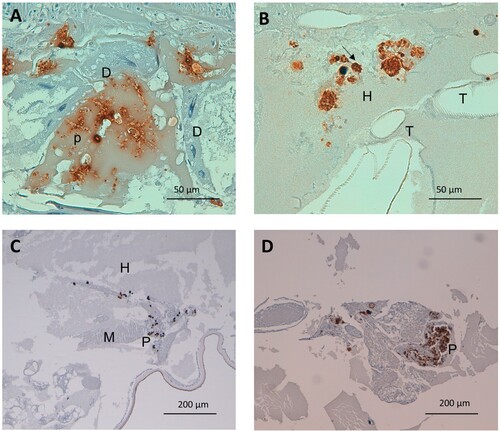 Figure 4. Detail on fungal and plasmatocyte characteristics as a response to G. mellonella infection by aggregative and non-aggregative phenotypes of C. auris. (A) C. auris pseudohyphae invading larval digestive epithelium, after infection with the aggregative strain CJ101. Anti-C. albicans antibody. 400× magnification. (B) Larval hemolymph containing yeasts of C. auris. Note the presence of intracellular yeasts within infected and plasmatocytes (arrow) undergoing cell lysis. Non-aggregative strain CJ175. Anti-C. albicans antibody. 400× magnification. (C) and (D) Small and large plasmatocyte nodules after infection with aggregative (CJ101) and non-aggregative (CJ175) strains of C. auris, respectively. Anti-MS13 antibody. 100× magnification. D, digestive tissue; H, hemolymph; P, plasmatocyte; T, respiratory tracheal system.