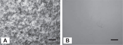 Figure 4 Typical microscopic images of culture medium containing the acid-treated SWNT (A) and the DNA-SWNTs (B).Notes: Scale bars = 100 mm. These images were observed at 5 minutes after the mixture of the acid-treated SWNT (or DNA-SWNT), and medium was prepared using a microscope (TS-100, Nikon, Tokyo Japan).Abbreviation: SWNT, single-walled carbon nanotube.