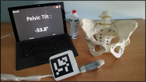 Figure 1. Device including the tab and the US probe equipped with an ARUCO marker.