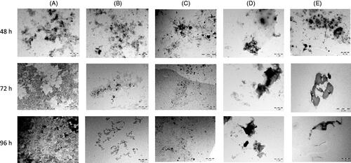 Figure 6. Electron micrographs showing the effects of seaweed extracts (200 µg/mL) on disaggregation of preformed Aβ1-42 at different intervals. (A) Control (Aβ1-42); (B) Aβ1-42 + ECK-AQ; (C) Aβ1-42 + RED-AQ; (D) Aβ1-42 + URL-AQ; (E): Aβ1-42 + GEL-AQ. The seaweed extracts were added to Aβ1-42 after 48 h.