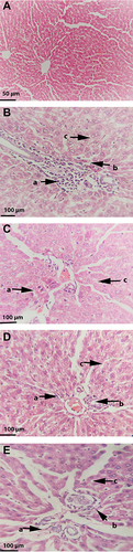 Figure 8 Effect of Safranal on the histopathology of HFD fed rat’s liver stained with hematoxylin-eosin. Images of representative sections of each group are shown lobular inflammation and steatosis around central vein. Where (arrow a) indicates oval cells hyperplasia, (arrow b) inflammatory cells, and (arrow c) steatosis. (A) Normal control group showing normal hepatocytes and central vein (magnification, 100x); (B) disease control group showing steatosis and severe inflammation around central vein with mixture of oval cells hyperplasia (400x); (C) group treated with standard botanical mixture showing moderate steatosis and inflammation (400x); (D) group treated with safranal-250 mg/kg dose showing moderate steatosis, inflammation and oval cells (400x); (E) group treated with safranal-500 mg/kg showing mild fatty infiltration, inflammation and oval cells (400x).