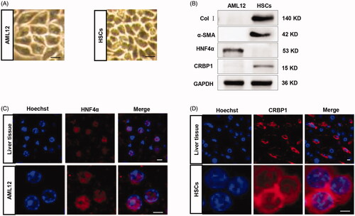 Figure 4. Validation and characterization of AML12 cells and HSCs. (A) Microscope image of the AML12 and HSC cells morphology; (B) western blot analysis of the expression of HNF4α/CRBP1 and α-SMA/collagen I in AML12 cells and HSCs. GAPDH served as the loading control. (C) immunofluorescence microscope image of the expression of HNF4α in the liver tissues and AML12 cells (scale bar = 5 μm). Nuclei were counterstained with Hoechst; (D) immunofluorescence microscope image of the expression of CRBP1 in the liver tissues and HSCs (scale bar = 2.5 μm). Nuclei were counterstained with Hoechst.