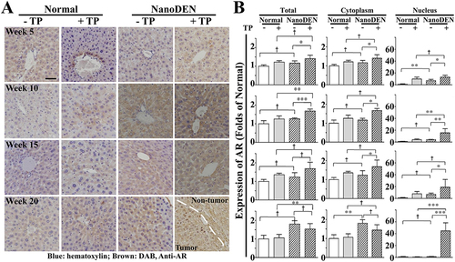 Figure 2 Nuclear expression of AR was significantly elevated after TP injection in nanoDEN-treated mice.
