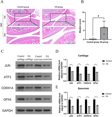 Figure 11 H&E staining shows that compared with the control group, the knee joint cartilage of mice in the OA group showed significant cartilage degradation(A). Mankin score in OA group was higher than that in control group(B). The results of Western blot (C) and qRT-PCR (D and E) showed that the expression levels of JUN, ATF3, CDKN1A and GPX4 in the articular cartilage and synovial membrane of OA mice were lower than those in the normal group, *P<0.05, ***P<0.001.