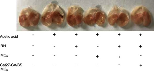 Figure S4 Macroscopic appearance and area of acetic acid-induced gastric ulcer after different treatments: normal; acetic acid; alginate/barium sulfate microcapsules (A/BS MCs); ranitidine hydrochloride (RH); ranitidine hydrochloride–chitosan alginate/barium sulfate microcapsules (RH-CA/BS MCs); and ranitidine hydrochloride–catechol-27–chitosan alginate/barium sulfate microcapsules (RH-Cat27-CA/BS MCs).