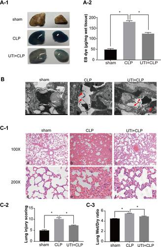 Figure 7 UTI repaired the barrier structure and relieved pulmonary capillary endothelial leakage in CLP-induced rat lungs. In the CLP group, EB inundated the lung tissue, while it was noticeably reduced in theUTI+CLP group (A). Electron microscope (B) showed that the barrier structure of CLP-induced rats was severely damaged (red arrow) when compared with the sham group; the gaps between endothelial cells were evidently narrowed and the barrier structure was reversed in the UTI+CLP group. Histopathological morphology was assessed by performing hematoxylin and eosin staining (C-1). The lung W/D ratio varied in different groups of rats (C-3). In the CLP group, severe pulmonary edema, interstitial hemorrhage, alveolar collapse, a large number of inflammatory cell infiltration (C-1b,e), higher lung injury score (C-2) and W/D ratio (C-3) occurred. Compared with the CLP group, the UTI+CLP group showed less destruction of lung structure (C-1c,f), lower lung injury score (C-2) and lower W/D ratio (C-3). *p<0.05.