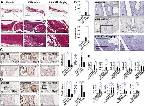 Figure 3 BT2 inhibits TRAP, ICAM-1 and VCAM-1 staining and circulating cytokine levels in arthritic mice. Further analysis was performed with material from mice injected i.p. with antibody cocktail on Day 0 then LPS plus BT2 (3 or 30 mg/kg in vehicle) i.p. on Day 3. (A) H&E-stained Day 14 hind limbs. The upper BT2 image was rotated for alignment as shown. (B) TRAP staining of Day 14 hind limbs. Black arrows provide examples of positive staining. Slides were photographed under 20x or 40x objectives. IOD of positive staining (red chromogen) was assessed using Image-Pro Plus software. Alternatively numbers of osteoclasts were counted using NIH Image J. Data represents the mean ± SEM of the means. Statistical significance was assessed by Wilcoxon signed-rank test. n=6–10 per group. (C) Immunohistochemical staining for ICAM-1 in Day 14 hind limbs. IOD/µm2 and percentage of positive staining cell per 20x objective view were assessed for ICAM-1 using Image-Pro Plus software. Data represents the mean ± SEM of the means. Statistical significance was assessed by one-way ANOVA and Mann Whitney test. n=3–5 per group. (D) Immunohistochemical staining for VCAM-1 in Day 14 hind limbs. IOD/µm2 and percentage of positive staining cell per 20x objective view were assessed for VCAM-1 using Image-Pro Plus software. Data represents the mean ± SEM of the means. Statistical significance was assessed by one-way ANOVA. n=3–5 per group. (E) Plasma cytokine levels in arthritic mice treated with BT2. Cytokine levels were detected using a bead-based multiplexed system according to the manufacturer’s protocol. Statistical significance was assessed by Kruskal Wallis test. n=4–5 per group. *P<0.05, **P<0.01, ***P<0.001, ****P< 0.0001.