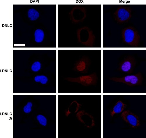 Figure 4 Intracellular uptake at 12 h post-incubation of DNLC and LDNLC (pretreated with/without 60 μM of dicoumarol [Di]).Note: Scale bar: 20 μM.Abbreviations: DNLC, DOX mono-delivery NLC; LDNLC, NLC co-delivering Lapa and DOX; DOX, doxorubicin; NLC, nanostructured lipid carrier; Lapa, β-lapachone.