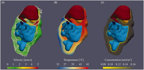 Figure 5. 3D representation of the flow velocity (A), temperature distribution (B) and cisplatin concentration (C) around the intestines (light blue), liver (dark red) and stomach (orange) resulting from case # 1. The red and blue catheters represent the inflow and outflow, respectively. The catheter positions are indicative in the 2D plane orthogonal to the depth. A high flow velocity is observed near the inflow next to the stomach. The arrows depict the flow direction. Flow velocities decrease significantly near the rectum of the rat, which result in thermal heterogeneities. The heterogeneities in concentration of chemotherapy are relatively small, although the surface concentrations near the peripheral regions are lower.