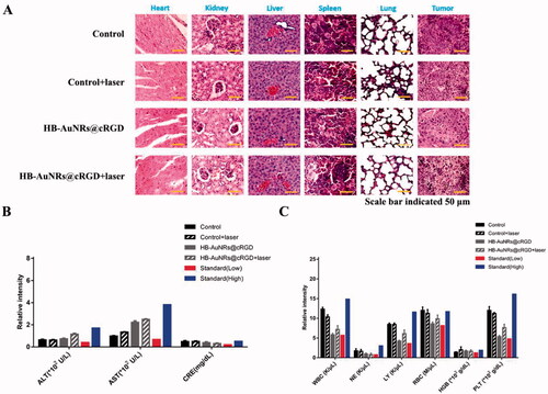 Figure 10. In vivo biosafety assessment. (A) H&E stained images of major organs and tumor tissue sections collected from different treatment groups on 15 days post-treatment. (B) The aspartate transaminase (AST), alanine aminotransferase (ALT), blood creatinine (CRE) analysis in the serum, and (C) the hematological parameters of the mice collected from different treatment groups on 15 days post-treatment. Error bars represented the standard deviations of three mice per group.