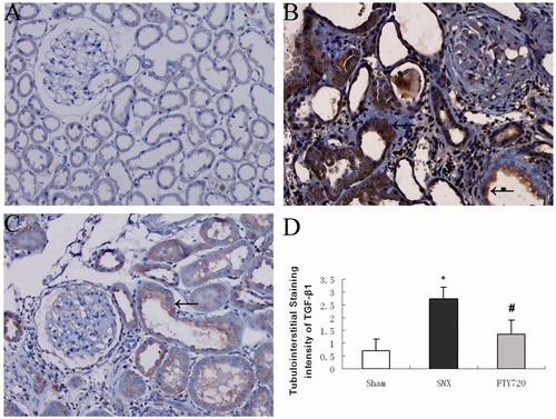 Figure 6. Effects of FTY720 on the expression of profibrotic molecules (TGF-β1). Representative tubulointerstitial immunostaining of TGF-β1 are shown for the sham (A), untreated SNX (B) and SNX+FTY720 groups (C). FTY720 treatment prevented the upregulation of TGF-β1 in the tubulointerstitial area (D). Original magnification: ×200. Data are presented as the mean ± SD, n = 8, *p < 0.01 versus sham, #p < 0.01 versus SNX.