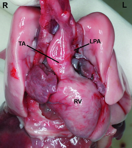 Figure 3.  In the pathology specimen, the left pulmonary artery originates from a common arterial trunk (TA) arising from the fetal heart. RV, right ventricle; TA, truncus arteriosus; LPA, left pulmonary artery; R, right; L, left.