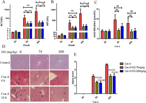 Figure 1 Pre-treatment with DG improves the liver injury upon challenge with Con A. Levels of serum alanine aminotransferase (ALT) (A) aspartate aminotransferase (AST) (B) and total bilirubin (C) in mice treated with different doses of DG before and after Con A administration for 6 hrs and 24 hrs. (D) H&E staining for livers (200x). The black arrows indicate the inflammatory infiltration and necrosis areas. (E) The injury score evaluation was in accordance with pathological staining. Data in the graph indicate P-values between the DG pretreatment and control groups. *, ** mean P < 0.05 and P < 0.01, respectively. N = 8 for each group. This experiment was performed in triplicate.