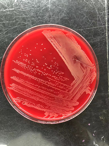 Figure 1 Culture on blood agar plate.