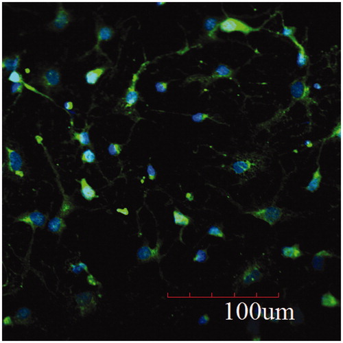 Figure 2. Hippocamoal neurons fluorescense staining with rabbit anti-rat neuron-specific enolase (NSE). The purity of hippocamoal neurons was calculated as over 87% (×200).