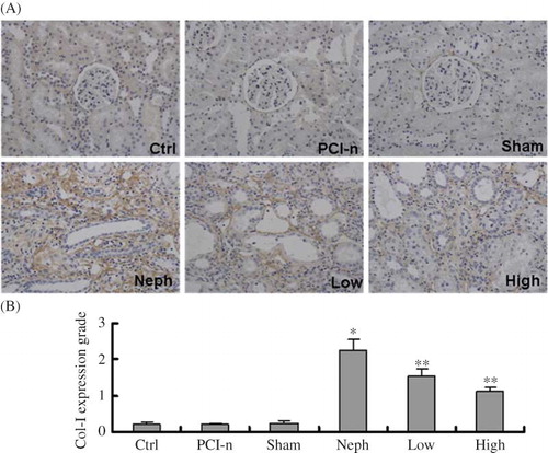 Figure 6.  Immunohistochemical staining of Col-I protein in different groups of rats. (A) Staining of injured renal tissues by Col-I antibody (200×); (B) Quantification of Col-I expression. Col-I expression was the strongest in the Neph group. Ctrl, control group; PCI-n, PCI-neo group; Sham, sham-operation group; Neph, 5/6 nephrectomy group; Low, low-dose PCI-neo-HGF group; High, high-dose PCI-neo-HGF group. *p < 0.05 versus Ctrl group; **p < 0.05 versus Neph group.