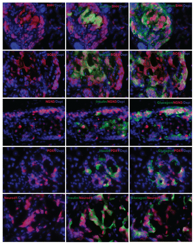 Figure 7 Islet transcriptional factors seen in the nucleus of insulin and glucagon positive cells in the pancreas of diabetic rat one week after UTMD with cyclin D2/CDK4/GLP1 (animals euthanized one week after UTMD). x600 magnification.