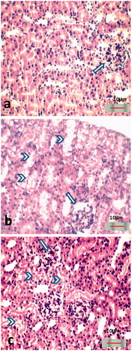 Figure 2. Hematoxylin and eosin-stained kidney sections. (a) Control groups (G1 and G2) showing normal renal tubules and glomerulei (arrow), (b) CTX-treated group (G3) showing shrinkage of the glomerulei (arrows) with distinct vacuolated and degenerated epithelial lining cells of the renal tubules (arrow heads), (c) CTX- and propolis-treated group (G4) showing the disappearance of glomerular shrinkage (arrow) and mild degeneration of the renal epithelial cells (head arrows).