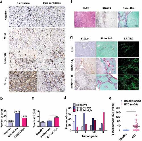 Figure 1. S100A4 expression is associated with fibrosis-related HCC. (a) Immunohistochemical staining of S100A4 in 75 HCC tissues and 75 adjacent cancer-free tissues in a tissue array was performed. (a) Representative S100A4 staining is shown. (b) Percentage of the cases expressing S100A4 in carcinoma tissues. (c) Average tumor size in HCC patients with different S100A4 protein levels. * P < .05. (d) Percentage of tissues with negative, low and high S100A4 expression with different tumor grades. (e) Serum S100A4 levels in healthy donors (n = 20) and HCC patients (n = 20) were detected by ELISA. *** P < .001. (f) Immunohistochemical staining including H&E, S100A4 and Sirius Red staining of adjacent tissue sections of human HCC tissues. (g) S100A4 expression in mouse models of HCC. Adjacent sections of HCC tissues were stained for S100A4, Sirius Red and ER-TR7 in C57BL/6 mice treated with DEN for 8 months, C57BL/6 mice treated with DEN and CCl4 for 8 months, and C57BL/6 mice treated with DEN and anti-CD137 agonist antibody (2A) for 8 months. Scale bar, 100 μm